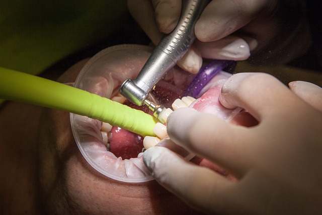 Tekutá strava po operaci zubů: Co jíst, když nemůžete žvýkat?