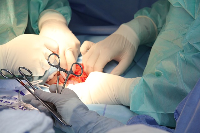- Detailní pohled na chirurgický postup plastiky křížového ⁢vazu⁢ bolest
