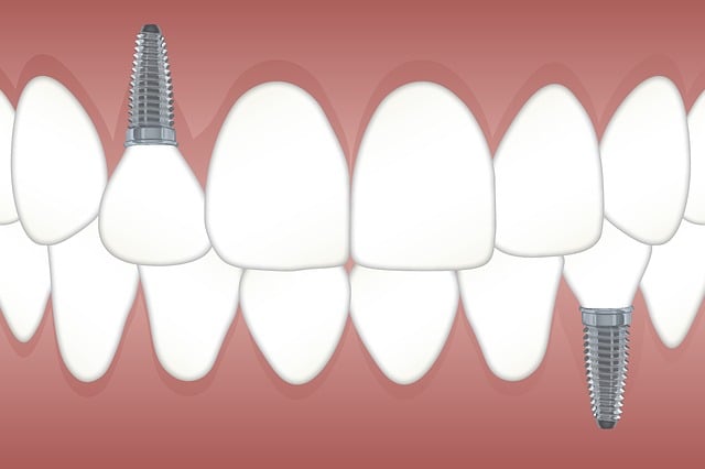 Důležitost ⁢pooperativní ‌péče po ⁢operaci zubu