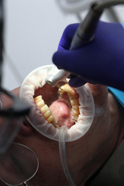 Nejlepší metody bělení zubů