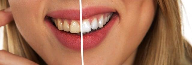 Bílé zuby kniha: Kompletní průvodce zdravým úsměvem